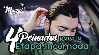 4 Peinados para la etapa incómoda  El Macho [upl. by Charity739]