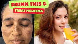 Drink this to treat Melasma amp Pigmentation  Nipun Kapur [upl. by Vassell]