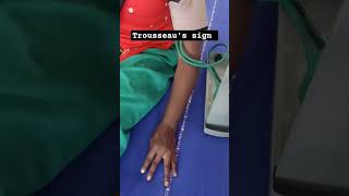 Trousseaus sign in latent tetany hypocalcemia [upl. by Hedve875]