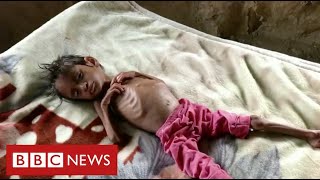 Millions of children face starvation in Yemen warns United Nations  BBC News [upl. by Irok]