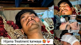 Hijama treatment vlog  Sunnat  Adnan Pathan Vlogs [upl. by Neelyar]