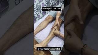 Pronated foot 🦶 feet 👣 trending ytshorts [upl. by Clyte]