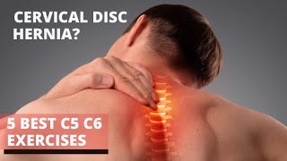 4 Best Cervical Disc Herniation Exercises c5 c6 neck pain exercises [upl. by Aivirt]