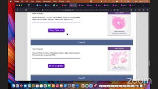 FRCPath 2 Histopathology Short Surgical Past cases discussion [upl. by Early]