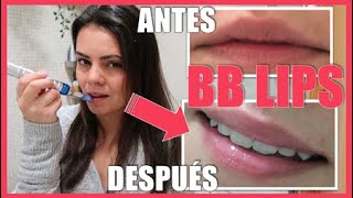 💋 BB LIPS en Casa 💋 TUTORIAL con DERMAPEN con Ácido HIALURÓNICO Dr Pen Nano Agujas Microneedling [upl. by Aicirtak]