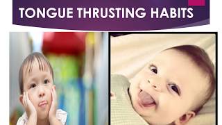 TONGUE THRUSTING HABITS  ORTHODONTICS I Dental Guide I Dr Bimal Chand I [upl. by Aehcsrop]