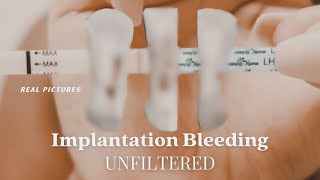 Understanding Implantation Bleeding [upl. by Elayor]