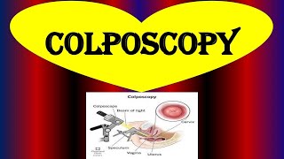 What is a Colposcopy  Colposcopy  Biopsy Purpose Procedure Risks and Results [upl. by Navannod]