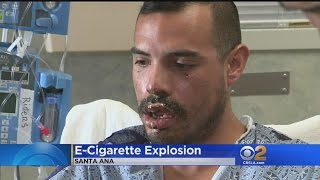 Tustin Man Recovering After ECig Explodes In His Mouth [upl. by Oninrutas]