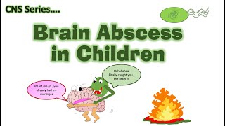 Brain Abscess  CNS Infections  Encephalopathy  CNS Series CH 11 [upl. by Asilim60]