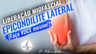 LIBERAÇÃO MIOFASCIAL EPICONDILITE LATERAL do COTOVELO FISIOTERAPIA MANUAL Clínica Dr Robson Sitta ® [upl. by Ailina]