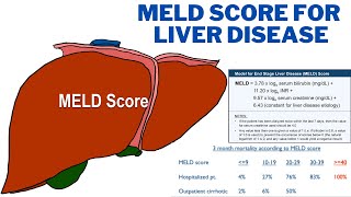 MELD Score for Liver Disease  How is the MELD score used to diagnose liver disease  247nht [upl. by Colan]