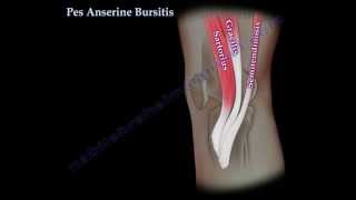 Pes Anserine Bursitis  knee pain  Everything You Need To Know  Dr Nabil Ebraheim [upl. by Erastes]