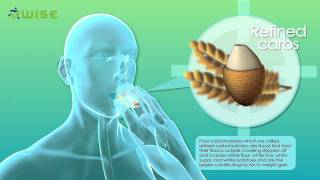 3D medical animation  Why people get fat  Warum Menschen Gewicht zunehmen  designidentity [upl. by Arved]