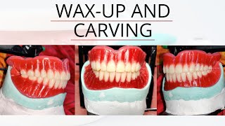 Wax up Carving and feestoning complete denture [upl. by Horne205]