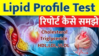 Lipid profile test in Hindi I Lipid profile Test Report कैसे समझे I [upl. by Eblehs]