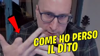 COME HO PERSO IL DITO [upl. by Trainor]