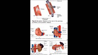 Pancreas Relations Anatomy Quick Revision University Exam [upl. by Otila440]