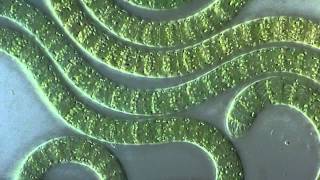 Cyanobacteria under microscope [upl. by Cleveland]