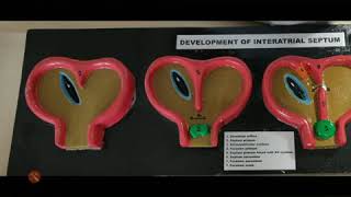 Development of interatrial septum exam model important [upl. by Obediah219]