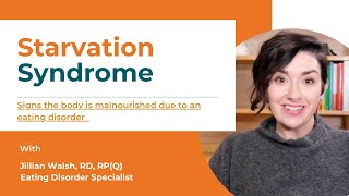 Does your child with an eating disorder show signs of Starvation Syndrome Eating Disorder in Teens [upl. by Rosalie]