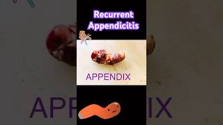 APPENDIX [upl. by Morey447]