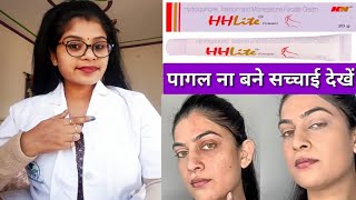 Skin Whitening HH Lite Skin Cream honest reviewHHLite cream benefits amp Sids effects review inhindi [upl. by Sigismond]