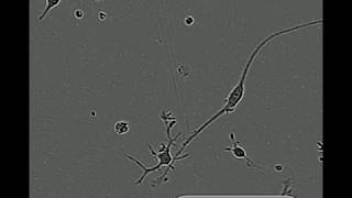 Cell Motility of Microglia Cultured in TIC [upl. by Scevor436]