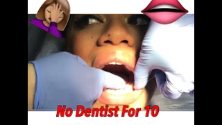 NO DENTIST FOR 10 YEARS I CANT BELIEVE WHAT MY MOUTH LOOKS LIKE [upl. by Eybba]