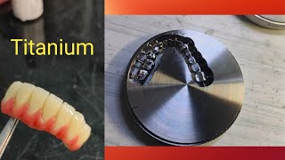 Dental  Titanium dental video [upl. by Ketty]