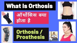 Orthosiswhat is OrthosisDifference between orthosis amp prosthesisTypes Useshealtheducatumhindi [upl. by Ailhat]