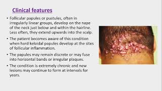 Lecture200 Acquired disorders of Pilosebaceous units Rooks chapter 93 [upl. by Ahsemad]