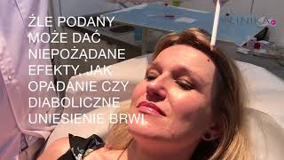 Botox na czoło  efekt naturalny dr Franciszek Strzałkowski Klinika Strzałkowski [upl. by Won]