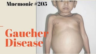 Gauchers Disease Mnemonic for USMLE Step 1 [upl. by Notwen429]