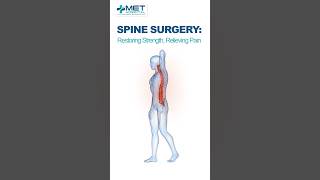 Experience expert spine surgery with advanced incision techniques spine spinehealth [upl. by Namra]