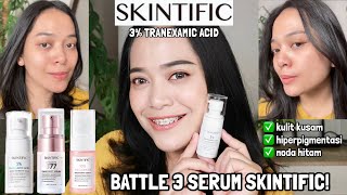 REVIEW TRANEXAMIC ACID SERUM SKINTIFIC EFEKTIF BUAT MENCERAHKAN WAJAH ✨ [upl. by Cadal931]