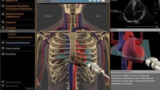 Basics of ultrasound machine [upl. by Yelyk71]