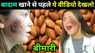 बादाम खाने से पहले ये वीडियो जरूर देखे  Badam Benefits In Hindi  Badam Side Effects [upl. by Labaw]