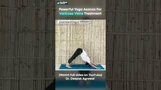 Yoga Exercise for Varicose Vein at Home  Part 7 yogaasanas varicoseveins [upl. by Sined19]