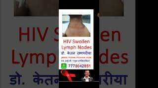 hiv swollen lymph nodes hiv hivtest hivtesting [upl. by Miguela]