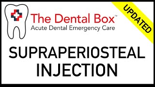 Supraperiosteal Injection Technique local tooth block [upl. by Aihsekan36]