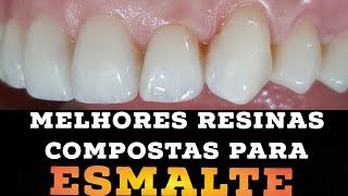 🛑MELHORES RESINAS COMPOSTAS DE ESMALTE NA PRÁTICA🎯🤫 [upl. by Marrilee]