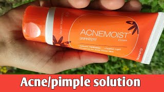 5 years of experience on using acne moist moisturizer  Honest review for acne prone skin [upl. by Compte467]