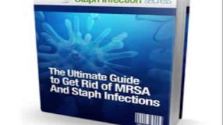 MRSA Treatment  Explore TheTips Of Staph Infetion Cure With Staph Infection Secrets [upl. by Ajroj832]