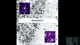 Midbrain Microglia Unique Cell Phenotypes and their Impact on Neuronal Function [upl. by Naerol]