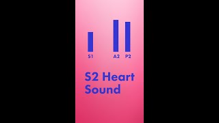 Split S2 Heart Sound  Shorts [upl. by Windzer]