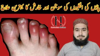 Sardiyo me pair ki ungli sujan ka gharelu ilaj  Herbalist Nafees [upl. by Shirah]