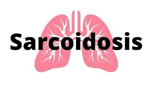 Sarcoidosis A Review rheumatology sarcoidosis [upl. by Kciredorb]