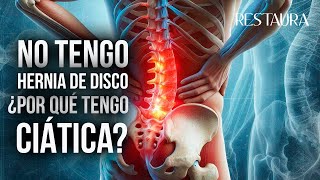 Si no tengo hernia de disco ¿Por qué tengo ciática [upl. by Mcdade916]