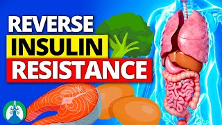 ❣️Top 10 Foods to REVERSE Insulin Resistance FAST [upl. by Gower383]